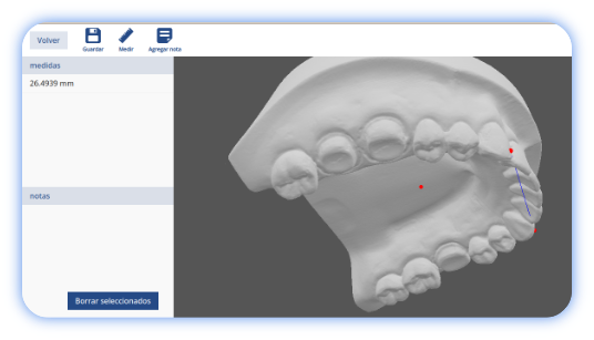 Escaneo 3D